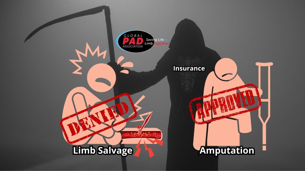 Insurance Prioritizing Amputations Over Limb&nbsp;Salvage?